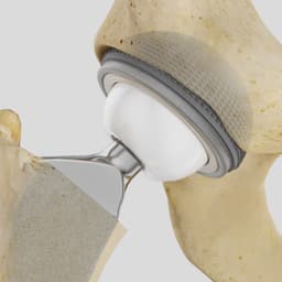 Isocer®-Product Picture CW Enlargement