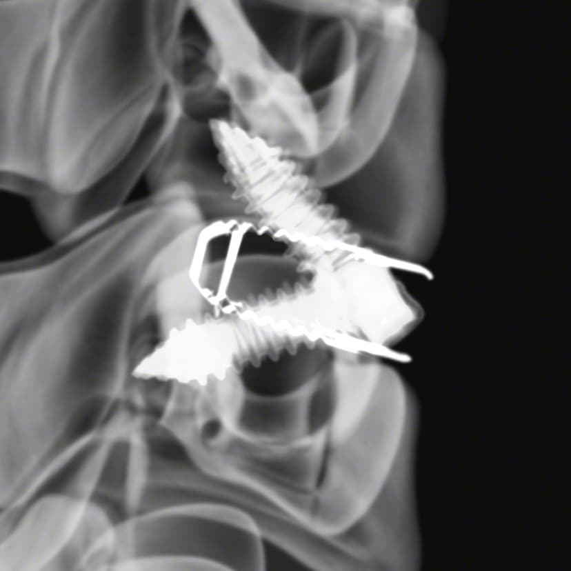 Arcadius XP C®-Product Picture