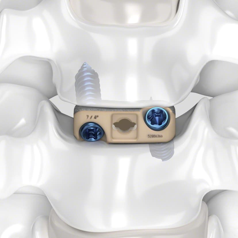 Arcadius XP C®-Product Picture