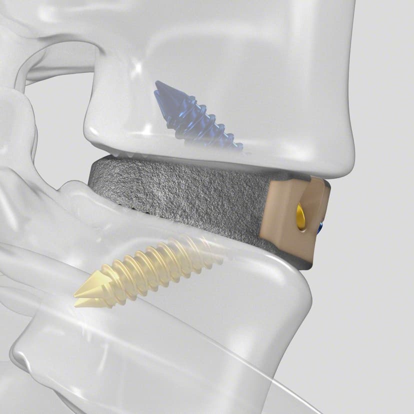 Arcadius XP L®-Product Picture