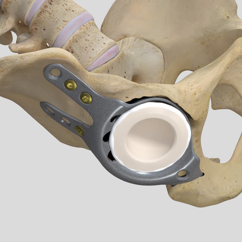 Reconstruction Shell-Product Picture